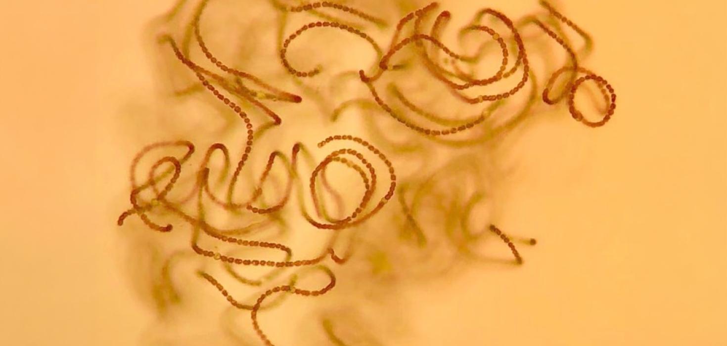 Blábakteríur úr Mývatni